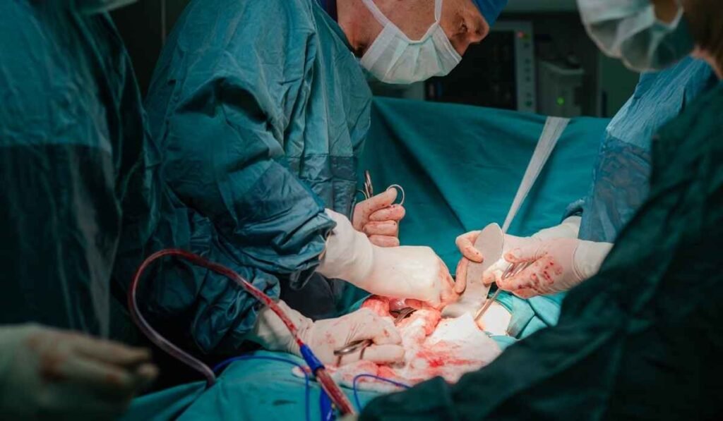 Hysterectomy