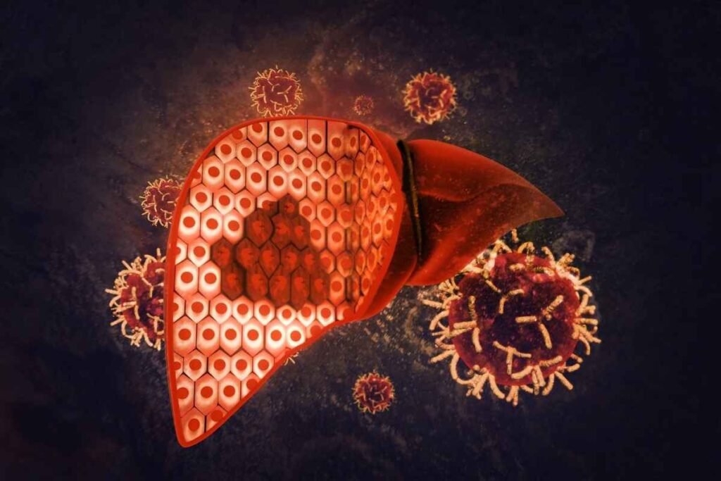 liver disease